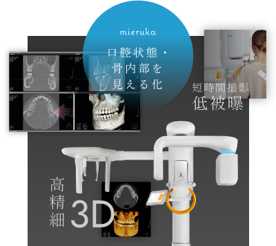 口腔状態・骨内部を見える化／短時間撮影 低被曝／高精細3D