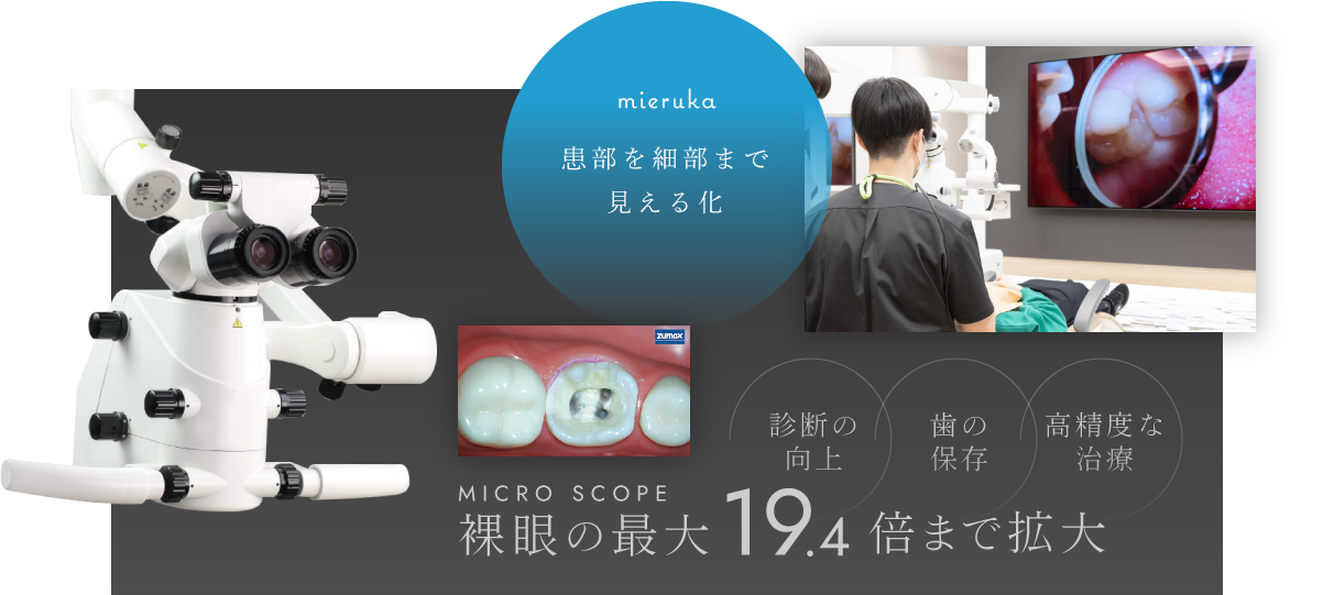 患部を細部まで見える化／裸眼の最大19.4倍まで拡大 診断の向上・歯の保存・高精度な治療