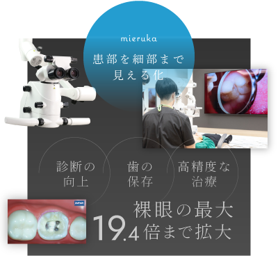 患部を細部まで見える化／裸眼の最大19.4倍まで拡大 診断の向上・歯の保存・高精度な治療