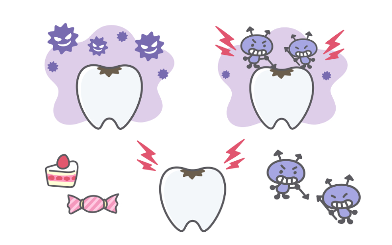 虫歯イメージ